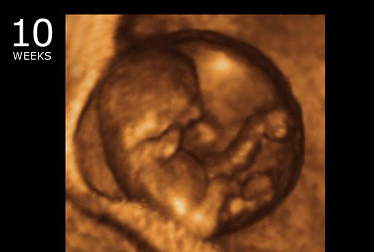 10 Haftalık Gebelik