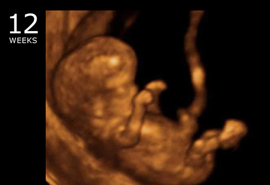 12. Hafta Gebelik