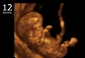 12. Hafta Gebelik